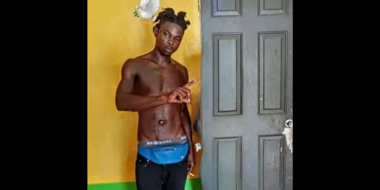 Image of Nyaim Calendar, the victim in the Tragic Marc Road Homicide, Saint Lucia's 78th recorded killing of 2024.